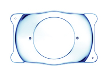 implantable contact lens